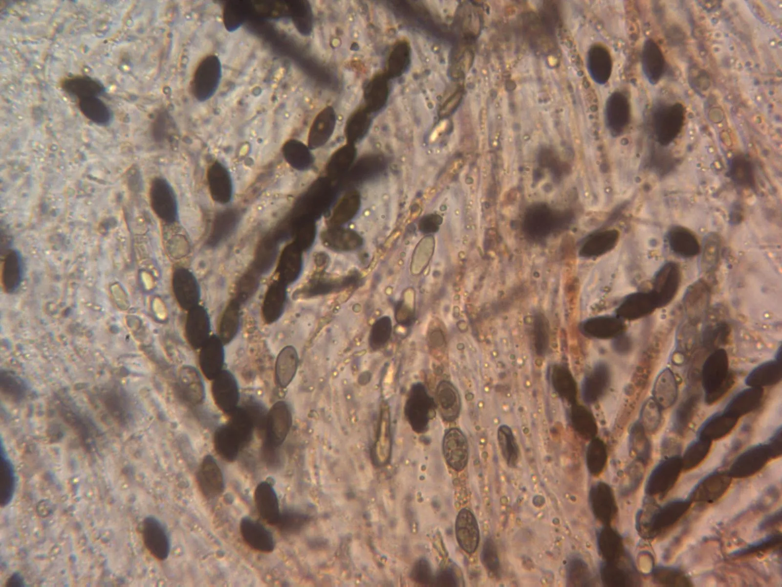 Microscopía de Nemania confluens - 10 - Ascas x 400